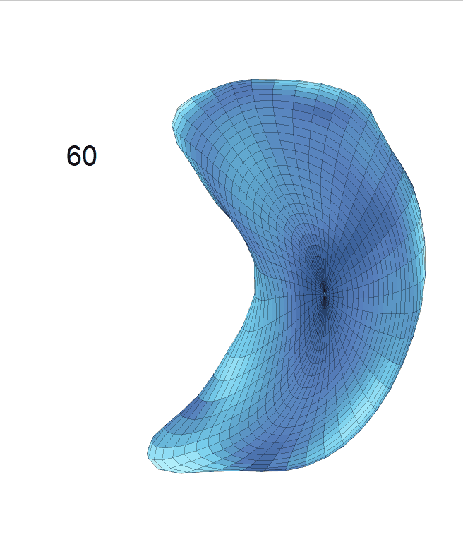hippocampus_AD_regression_surface