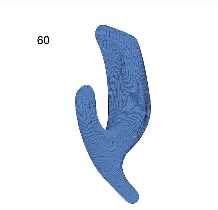 ventricle_NL_shape